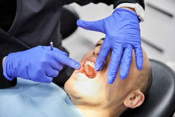 Best Emergency Denture Repair in Minoa, NY